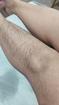 Renata Depiladora: estética em Maracanã, Praia Grande (foto 2)
