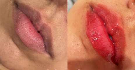 Jéssica Líbero Gonçalves: estética em Jockey, São Vicente