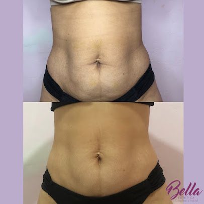 Bella Estética Facial e Corporal: estética em Vila Tupi, Praia Grande (foto 2)