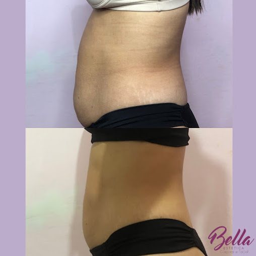 Bella Estética Facial e Corporal: estética em Vila Tupi, Praia Grande