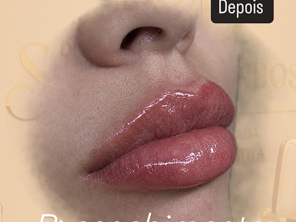 Clínica de Estética Dra.Suellen Barbosa: estética em Vila Tupi, Praia Grande