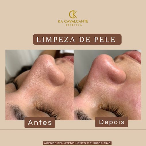 Ka Cavalcante Estetica Facial e Corporal: estética em Guilhermina, Praia Grande (foto 3)