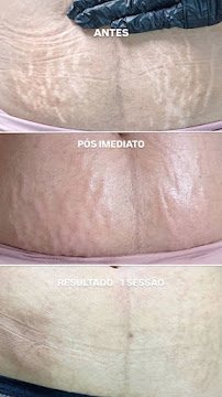 Samela Dias: estética em Centro, Peruíbe