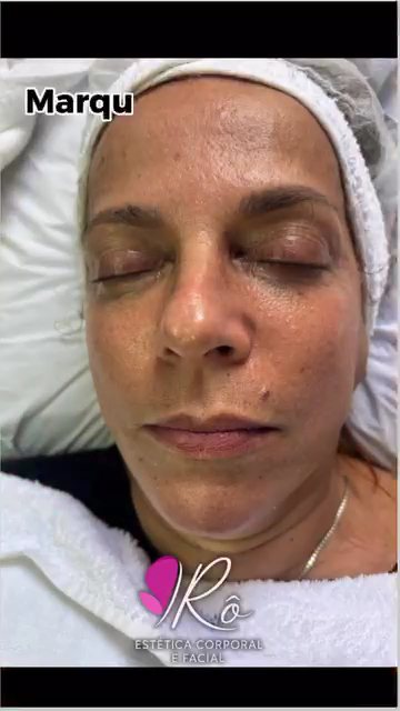 Rô Estética Corporal e Facial: estética em Cidade Ocian, Praia Grande (foto 2)