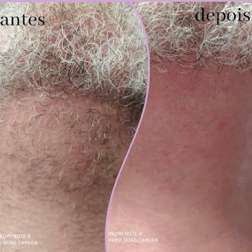 Estética Hérica Lima: estética em Vila Tupi, Praia Grande
