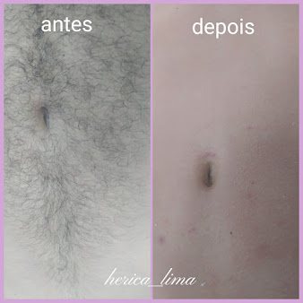 Estética Hérica Lima: estética em Vila Tupi, Praia Grande (foto 2)