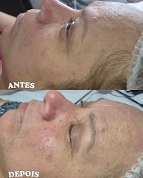 Beleza ao sol estética facial: estética em Cidade Ocian, Praia Grande