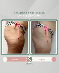 Sucaminu Estética Avançada: estética em Boqueirão, Praia Grande (foto 3)