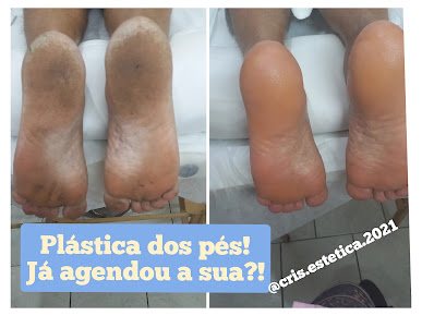 Cris Silva-Esteticista: estética em Parque das Bandeiras, São Vicente (foto 2)