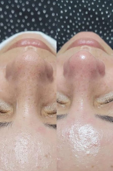 Dora Araújo Estética e Depilação: estética em Vila Tupi, Praia Grande (foto 2)