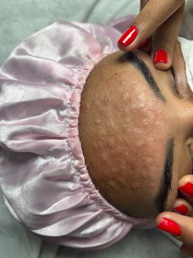 Meraki spa: estética em Aviação, Praia Grande